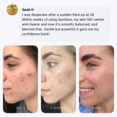 svensisland FACE BOGO: Spotless - Anti-Blemish Gel Cleanser